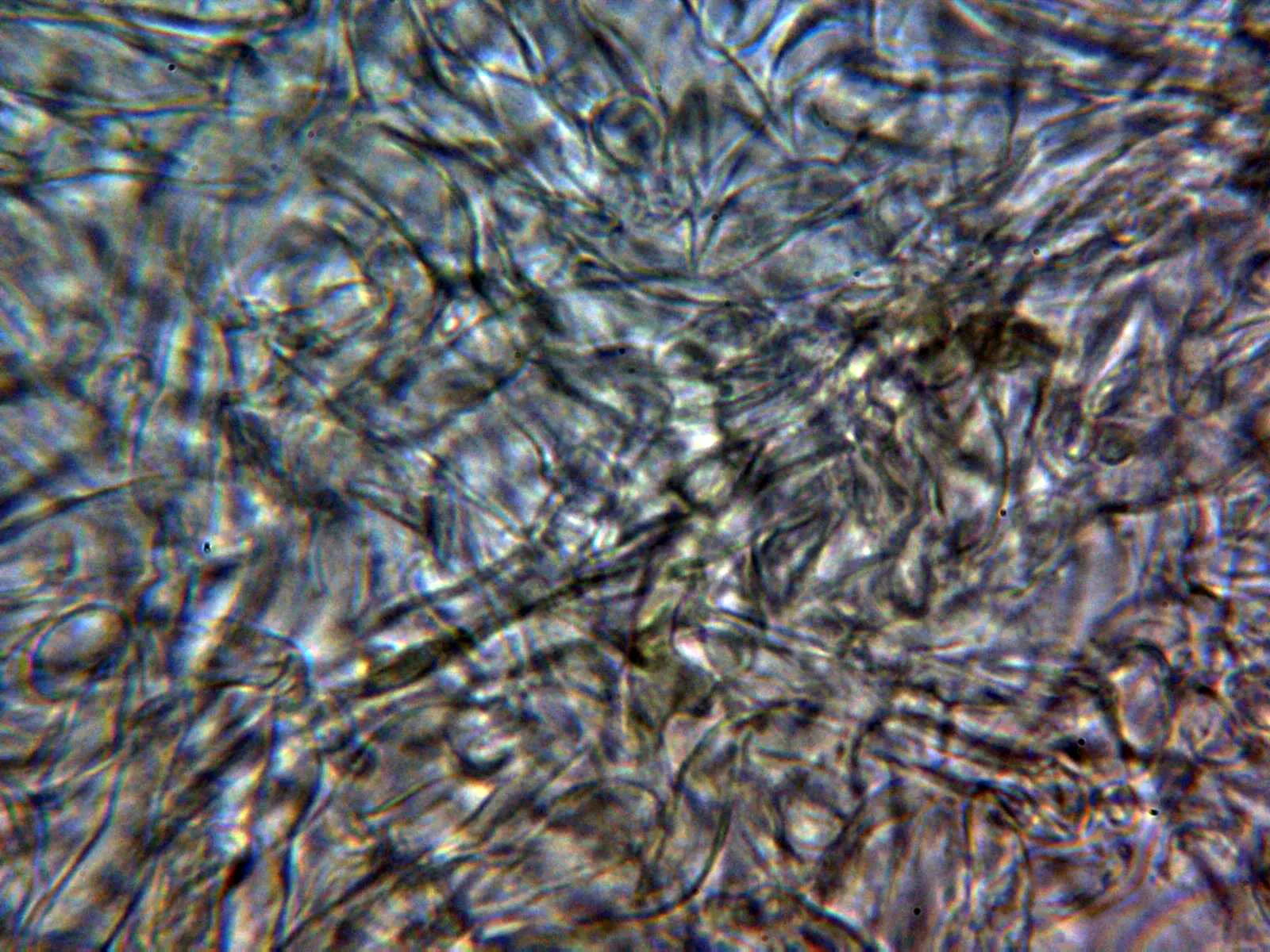 Microscopía de Inocybe posterula - 10 - Subpellis agua 1